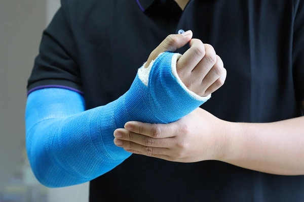 Close up of a man's arm wearing a blue cast from hand to humerus.